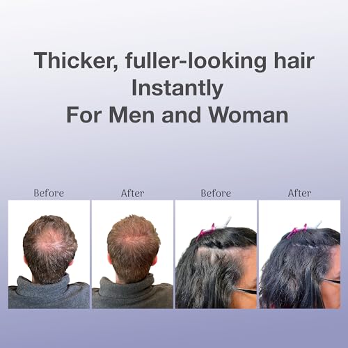 BosleyMD BosVolumize Hair Thickening Fibers, Hair Building Formula with Natural Keratin for Thinning Hair or Bald Spots, Hair Loss Concealer Men and Women, 4 Colors