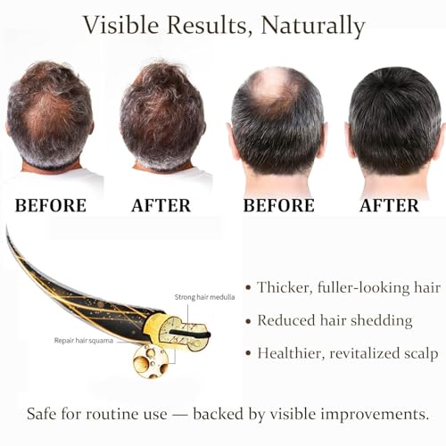 DEKOHAIR Hair Regrowth Serum, Advanced Scalp Treatment for Thicker, Fuller Hair, Reduces Shedding & Revitalizes Follicles, for Men & Women, 2 fl oz