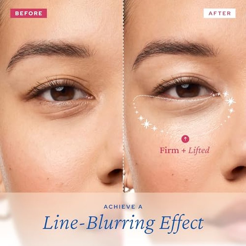 belif Aqua Bomb Lifting Eye Gel | Retinol + Collagen + Peptide for Firming & Plumping | Hyaluronic Acid for Glowy Hydration | Niacinamide for Dark Circles | Korean Skin Care
