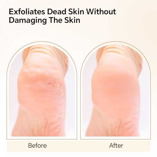 Nano Glass Foot File, Foot Callus Remover, Double Sided Pedicure Tools for Feet, Dual Use of Dry and Wet, Professional Hygienic Foot Scrubber to Achieve Smooth, Silky Feet Instantly (Golden)