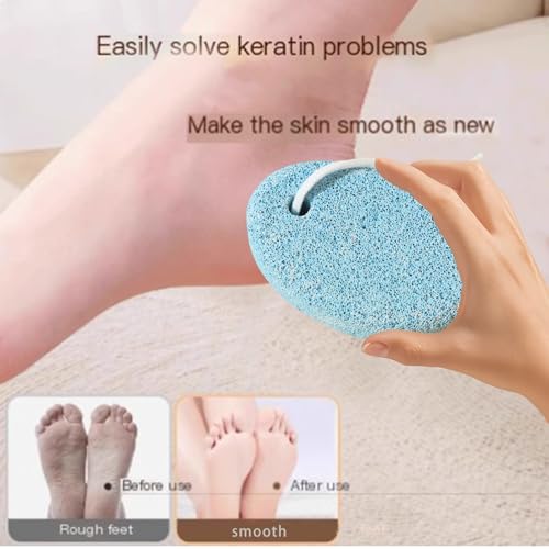 Pumice Stone for Feet Pedicure Tools Hard Skin Callus Remover Hands Foot File Exfoliation to Remove Dead(Blues)