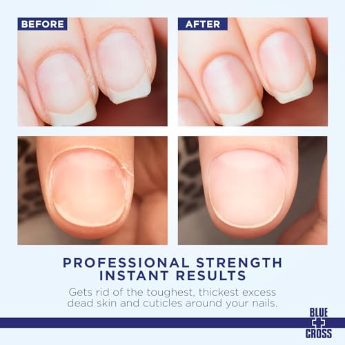Blue Cross Cuticle Remover Cream for Dry Damaged Cuticles, Moisturizing Cuticle Softener for Nails, Professional Nail Care for Dry Manicures, Brittle Hang Nails, Made in USA, 2oz