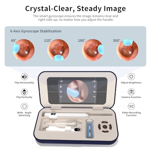 Sofbunny A03 Ear Wax Removal Tool Camera, Ear Cleaner with 1080P HD Camera, 3 in 1 Ear Cleaning Tool with 10 Replacement Tips,Earwax Remover Kit for Kids & Adults,Otoscope with LED Lights,256MB Card