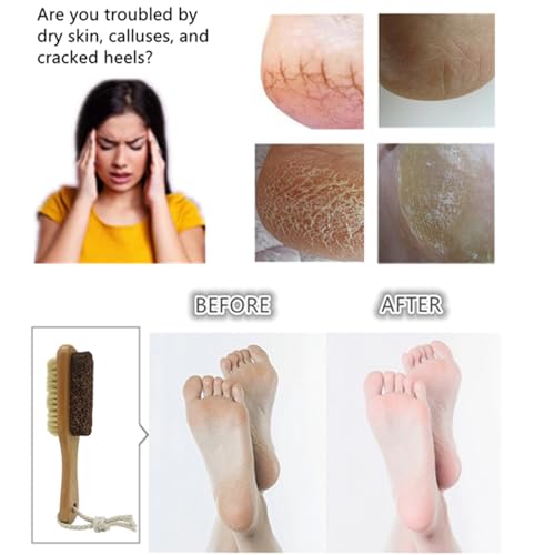 Natural Lava Pumice Stone for Feet with Brush, Callus Remover Foot Scrubber Exfoliator Pedicure Tools for Hard Dead Skin, Softer & Smoother Feet, Double Sided Boar Bristles Wooden Handle