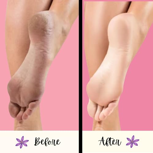 Mr. Pumice Purple PUMI Bar - Extra-Coarse, Pumice Stone for Feet Callus Remover, Pedicure Tools for Feet, Foot Scrubber for Dead Skin Remover, Foot Care, 4 Pack