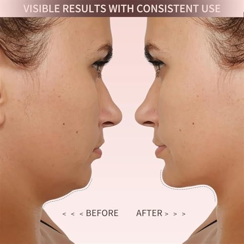 Eleve Beauty Face Shaper, Eleve Beauty V-Line Sculpting Face Mask, Chin Strap For Sleeping, Reusable Face Lift Chin Strap ? Silicone Double Chin Reducer For Jawline Tightening & Lifting (Classic Lift)