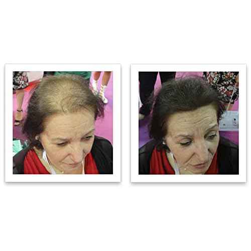 Caboki Hair Loss Concealer, 90-day supply, Dark Brown