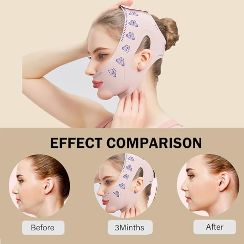 MASIKA Chin Strap for Sleeping,Jaw Strap,Jawline Shaper,V-Line Mask Chin Up Mask V Shaped Face Mask, Jaw Exerciser,Reusable,Butterfly