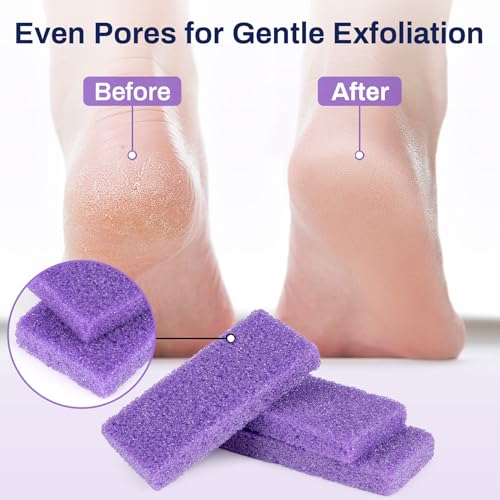 20 Small Pumice Stone for Feet - 3.6 X 1.8 X 0.47 Inch Purple Foot Pumice Stone Foot Filer Pedicura Scrubber for Callus Removal Foot Care Spa Productos for Dark Elbows Hard Skin Exfoliating