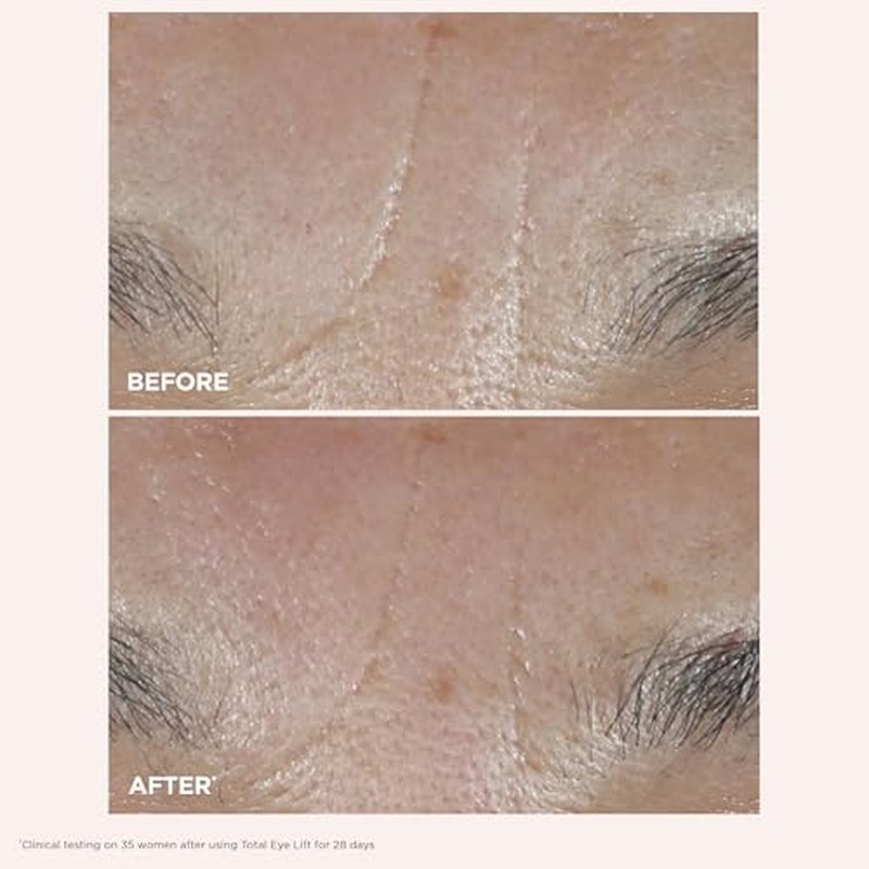 Clarins NEW Total Eye Lift | Anti Aging Eye Cream | Targets Wrinkles, Crow's Feet, Dark Circles and Puffiness For a Visible Eye Lift in 30 Seconds | REFILLABLE