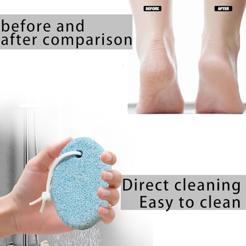 Pumice Stone for Feet Pedicure Tools Hard Skin Callus Remover Hands Foot File Exfoliation to Remove Dead(Blues)