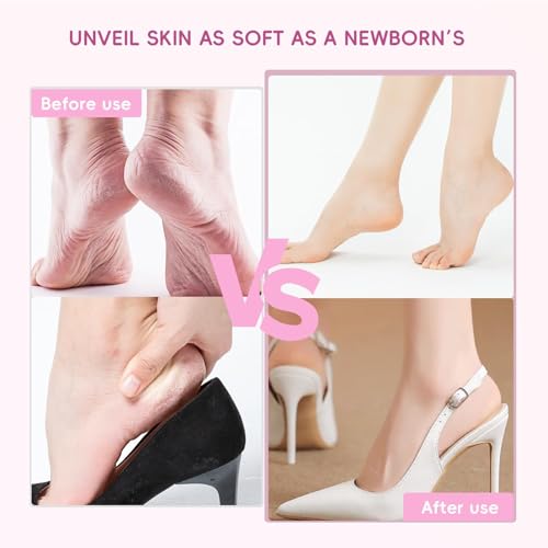 Electric Foot Callus Remover,Professional Foot Glass Sanding Machine with 9 Speed Settings, Type-C Charging, 3 Replaceable Rollers, Pedicure Tools with 30 Sandpaper Discs for Dead Skin-Black