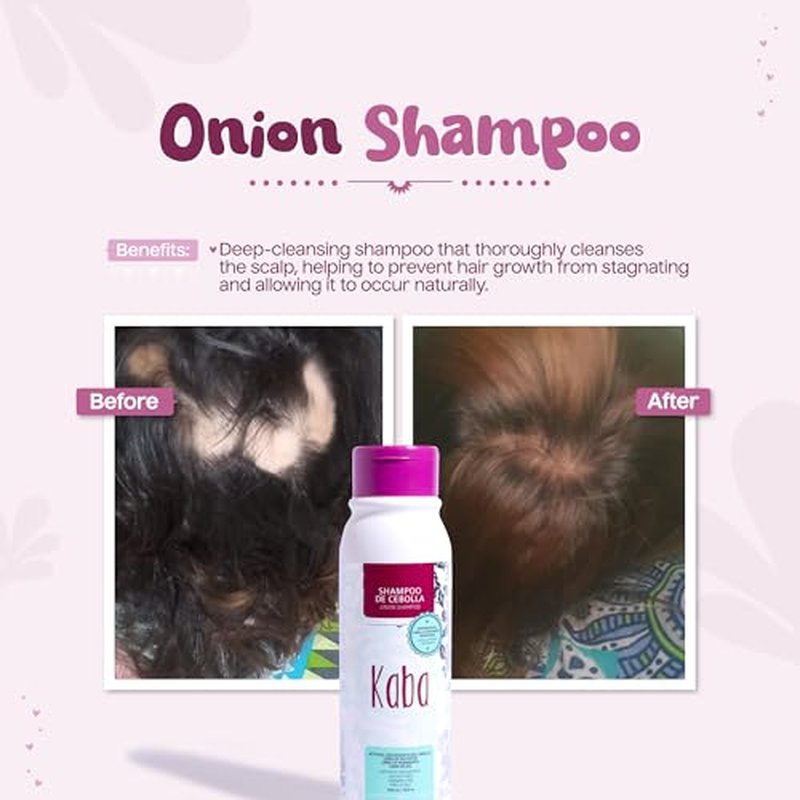Kaba Onion Shampoo de Cebolla for Hair Growth, Sulfate-Free, Paraben-Free, Stimulates Hair Regrowth, Reduces Hair Loss, Deep Scalp Cleanse, All Hair Types - 500 ML