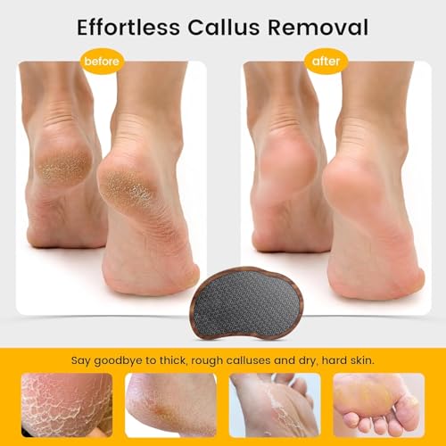 BEZOX Glass Foot Scrubber(1 PCS) - Nano-Glass Pedi Egg Pumice Stone for Feet Dead Skin, Plastic-Free Pedicure Foot File Callus Remover for Silky Smooth Feet - Walnut Wood Handled