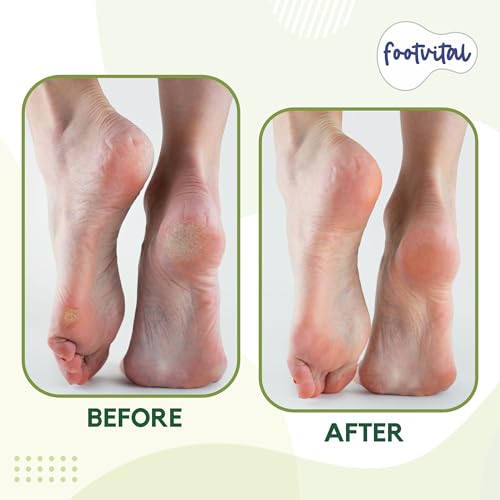 Pumice Stone for Feet, Foot Exfoliator Scrubber, Callus Remover, Made of Natural Terra-Cotta, Exfoliates & Smooths Rough Skin