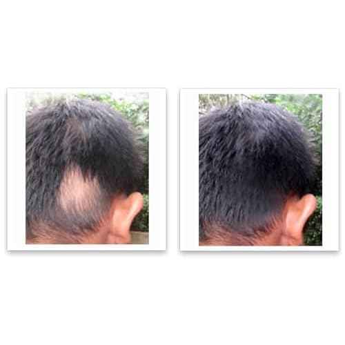 Caboki 10X Hair Powder for Thinning Hair, TALC-Free, Healthful Formula, Instantly Fuller Hair, Flawless Roots, Rain and Sweat Resistant, Easy to Use, Black, Unisex