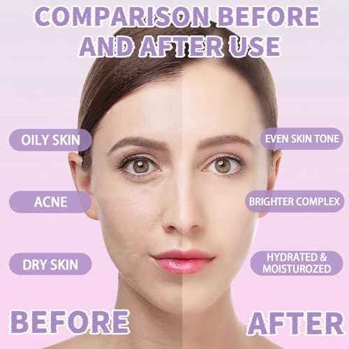 Jelly Mask Set,Hyalorunic Acid Jelly Masks For Facials Professional,Rose Hydro Jelly Face Mask,with Facial Mask Mixing Bowl Set,Headband,Birthday Gifts for Women,Gift Set for Valentine's, Mother's Day