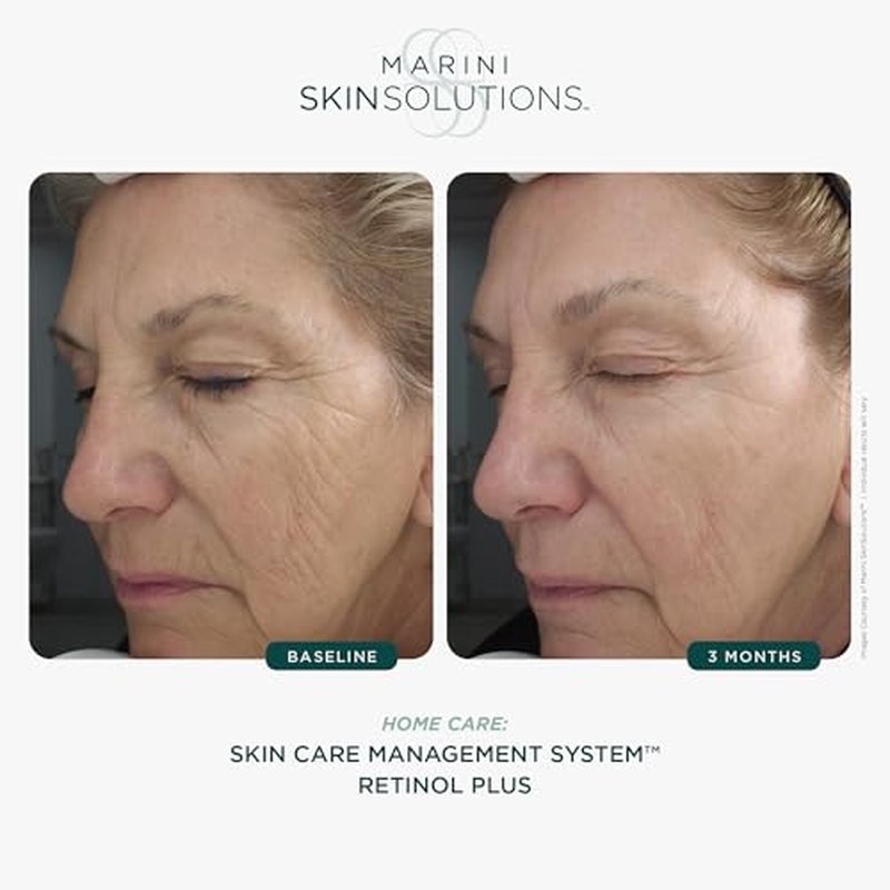 RETINOL PLUS