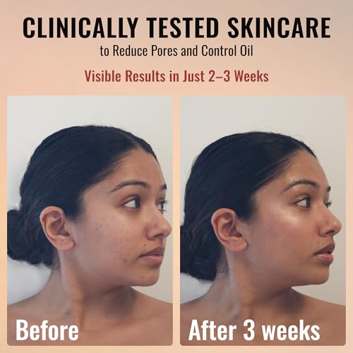 ADM Anti Aging Pure Retinol Serum For Face with Niacinamide - Resurfacing, Smoothing Fine Lines, Wrinkles, Acne Scars - Moisturizing Facial Skincare Treatment for Sensitive Skin - 1oz