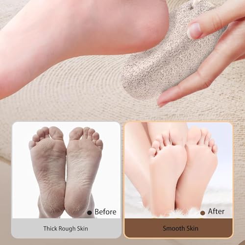 2PCS Natural Foot Pumice Stone£¬Natural Lava Pumice Stone for Feet, Foot Scrubber£¬Effective Pedicure Tools for Dead Skin and Callus Removal (Grey)