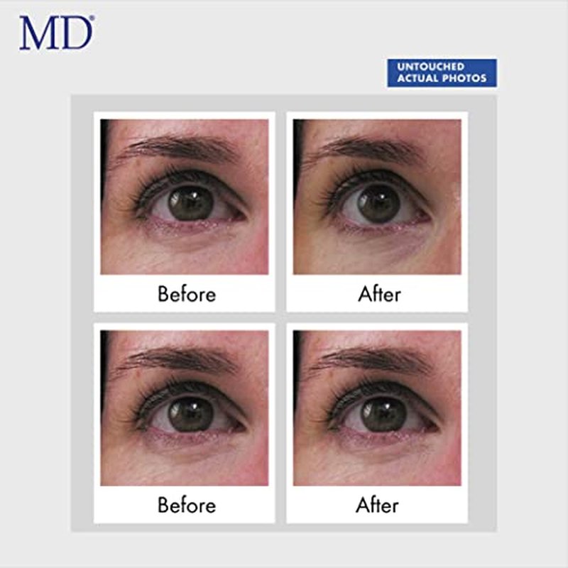 MD Ultimate Eye Cream ? Under Eye Cream for Reduced Dark Circles, Puffiness, Wrinkles, Bags & Anti-Aging ? Enriched with Collagen, Peptides, Shea Butter for Firmness, Lifting & Moisturization