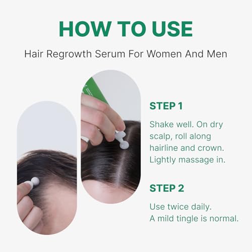 Spicule Microneedling Exosome Hair Growth Serum, Hair Loss Treatments for Women and Men, Peppermint Oil Cooling Scalp Serum, Menthol, Korean Hair Care (0.5 fl oz / 15ml)