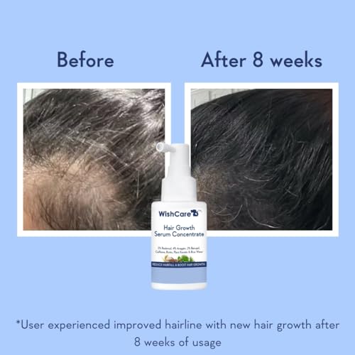 WishCare Hair Growth Serum Concentrate - Rosemary, 3% Redensyl, 4% Anagain, 2% Baicapil, Caffeine, Biotin, Plant Keratin & Rice Water