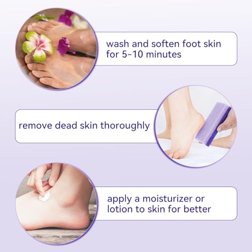 4 Pcs Foot Pumice Stone and Scrubber for Feet and Heels Callus and Dead Skins (Purple)