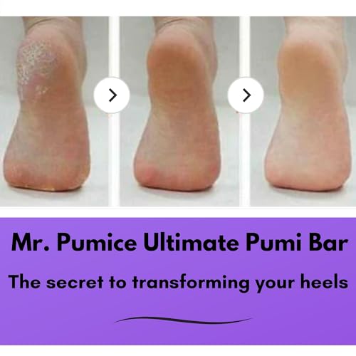 Mr. Pumice Ultimate PUMI Bar 2-in-1 Dual Grit (Medium + Coarse) Callus Remover, Pedicure Stone & Ped File Scrubber for Smooth Feet and Heels (4 Pack)