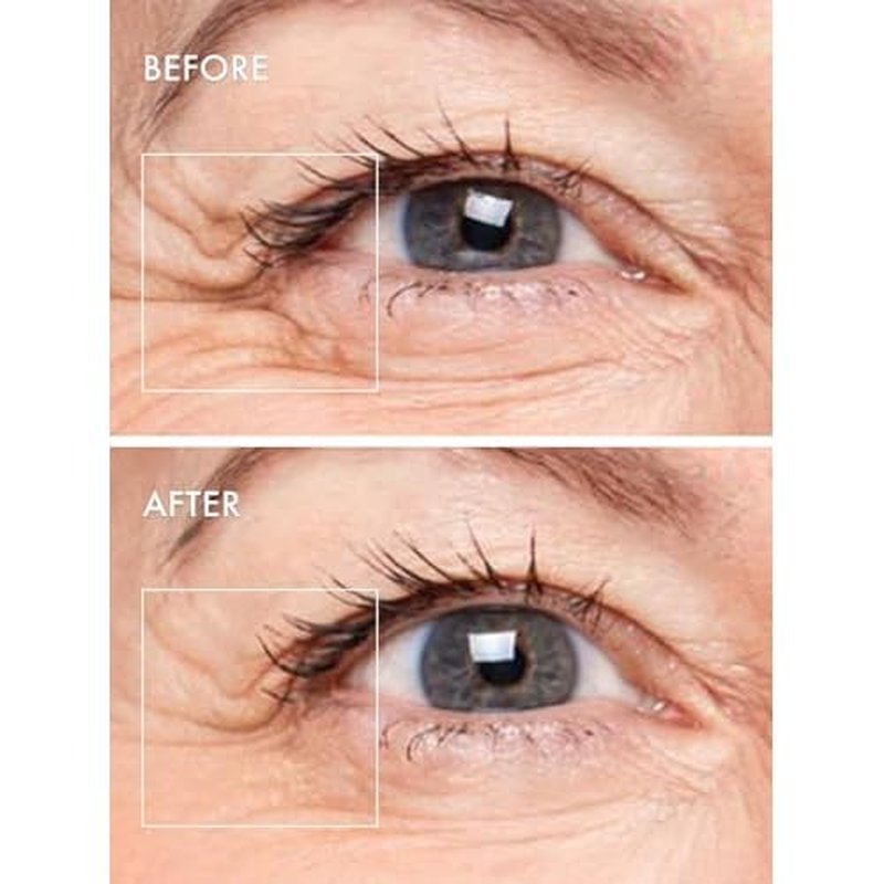 depology Deepcare+ Serum-Infused Micro Dart Patche | 4 Pairs Eye Mask | Under Eye Patches for Wrinkles | Fine Lines | Hydrating Eye Mask with Peptides | Amino Acids | and Synthesized Molecules