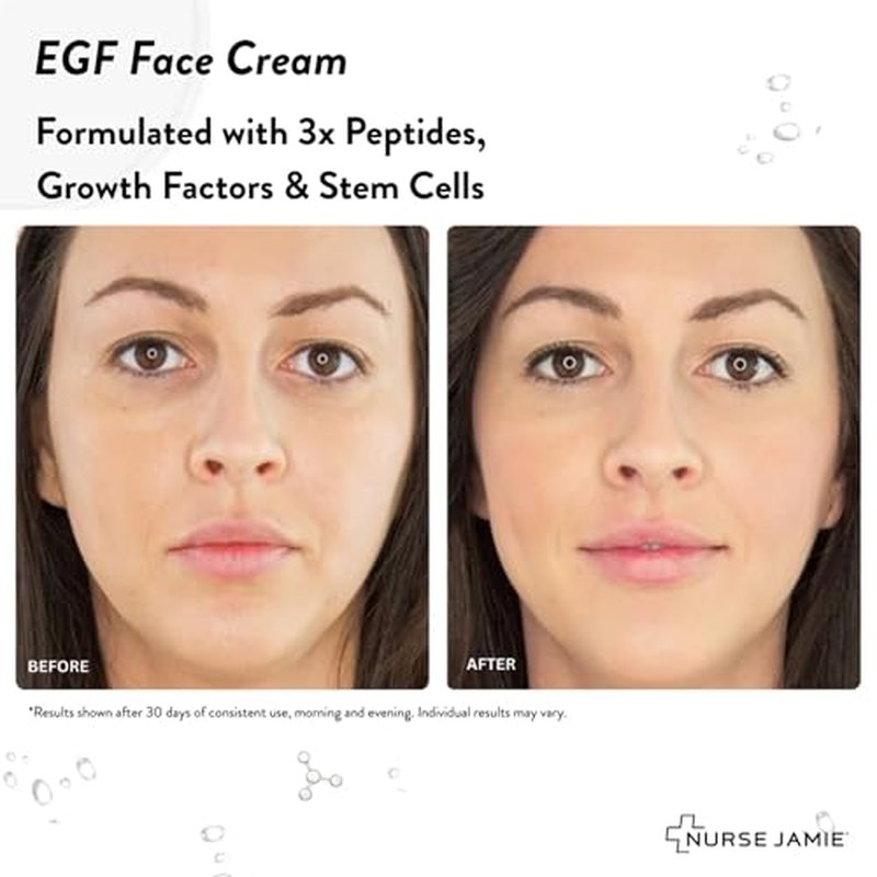 Nurse Jamie EGF Face Cream ? Advanced Anti-Aging Moisturizer with Plant Stem Cells & Peptides