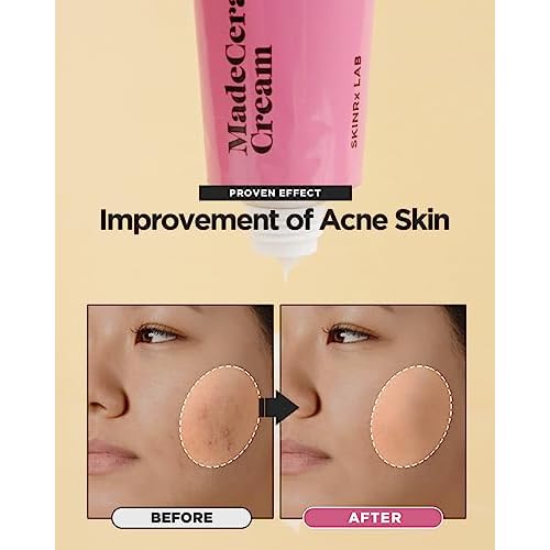 SKINRxLAB Made Cera Cream - Acne & Redness Relief Face Moisturizer, Sebum Control, Improving Skin Barrier with Ceramide and Madecassoside, Anti-Aging and Pore Minimizing Face Cream, 1.69 fl.oz.