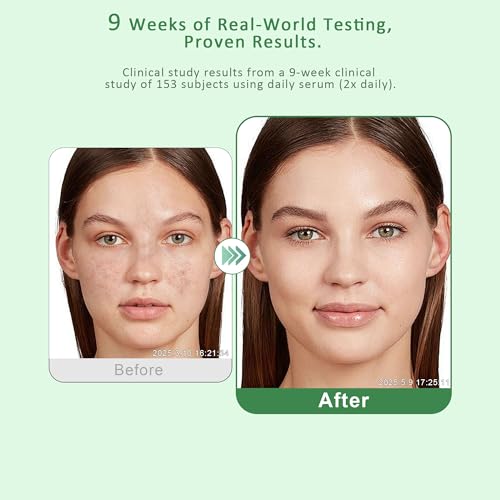 Dark Spot Remover for Face & Body ? Dark Spot Corrector Serum for Hyperpigmentation, Brown Spots & Melasma Treatment - 1.7 fl oz