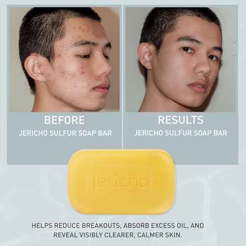 Jericho Dead Sea Sulfur Soap with Olive Oil – Helps with Acne, Psoriasis, Eczema & Blackheads – For Oily to Normal Skin – Vegan Face & Body Bar for Men & Women, 4.4 Oz / 125 g (Pack of 6)
