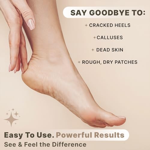 Pumice Stone for Feet - Natural Lava Stone Foot Exfoliator, Callus Remove for Feet, Hands & Dead Skin, Foot Scrubber for Pedicure & Cracked Heels, Strong & Durable Design for Smooth & Soft Feets