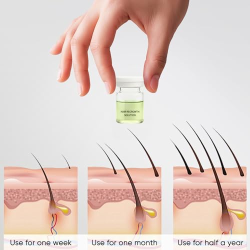 Hair Regrowth System ? Advanced Hair Growth Treatment with Ginseng, Eclipta Prostrata, Peppermint Oil & Ginger Root, Thickening Serum for Men & Women