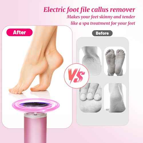 Electric Foot Callus Remover with 80pcs Sandpape Discs, Professional 800RPM Aluminum, Callus Remover for Feet Pedicure Tool for Dead Skin and Calluses, Stepless Speed Control Foot File 2 in 1