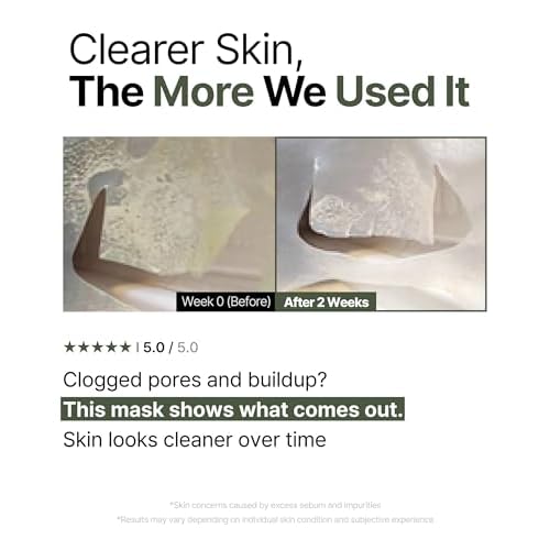 Trouble Patch Mask ? Full-Face Acne & Sebum Control Korean Sheet Mask with Tea Tree Biome, Hydrocolloid-Inspired Care for Oily Skin, Visible Sebum Lift, Holiday Skincare Gift | 20ml x 4