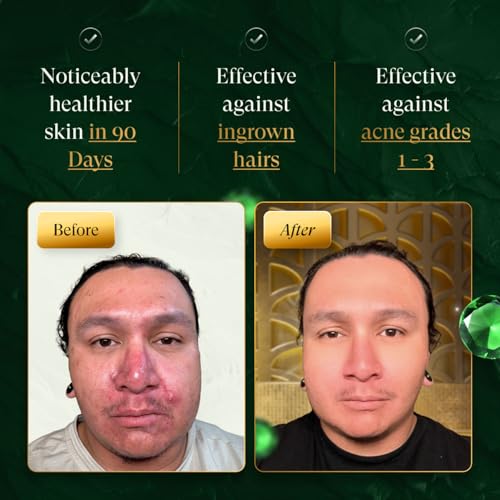 douxds Flex¢â Pro Vibrating Face Brush, Electric Face Scrubber, Face Scrubber for Men, Flex¢â Face Brush, Men's Skin Care, Powerful Sonic Technology, Removes Dark Marks and Bumps, Acne Treatment