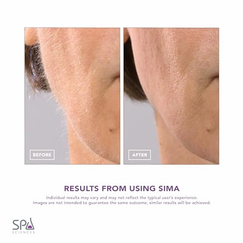 SPA SCIENCES - SIMA Patented Dermaplane Razor for Women Face ? Painless 2-in-1 Facial Exfoliation & Peach Fuzz Hair Removal ? Anti-Aging ? 3 Speeds ? Rechargeable ? 7 Weeks Treatment