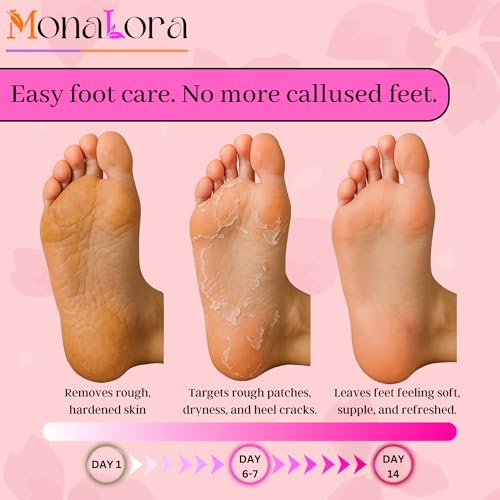 Foot Peel Mask for Dry, Cracked Heels ? Exfoliating Callus Remover with Natural Fruit Extracts ? Baby Soft Feet in 1 Week ? 2 Packs | Strawberry Scent