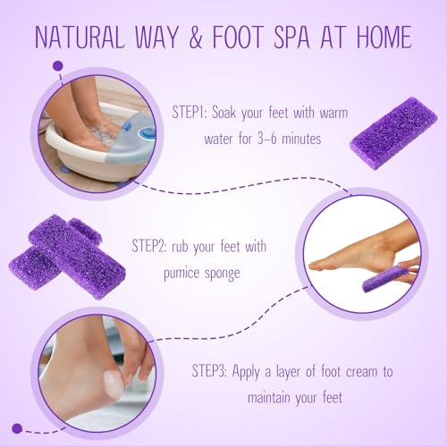 Batiyeer 100 Pcs Pumice Stone for Feet Scrubber Dead Skin Disposable Foot Pumice Foot Shower Scrubber Foot Scrubber for Heel Cuticle Callus Remover Bath Spa (Purple)