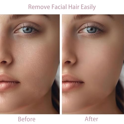 Women Facial Hair Removal Device Battery Operated with 2 Replacement Heads,Ladies Face Shaver for Peach Fuzz Upper Lip,Chin,Facial Hair Removal for Women