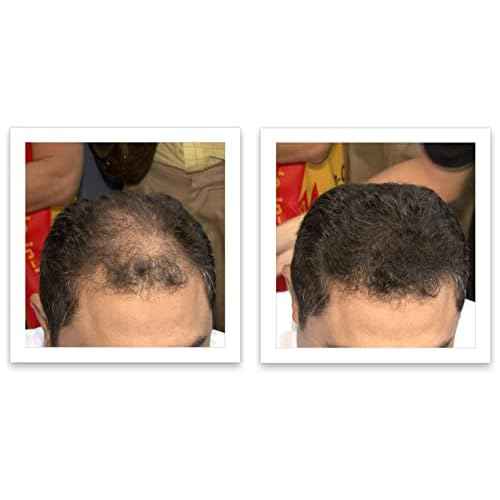 Caboki Hair Loss Concealer, 90-day supply, Dark Brown