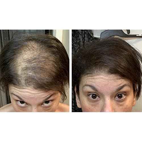 Caboki Hair Loss Concealer, 90-day supply, Dark Brown