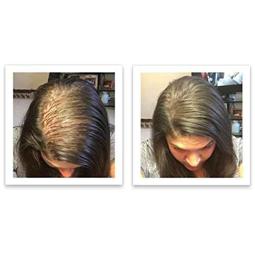 Caboki Hair Loss Concealer, 90-day supply, Dark Brown