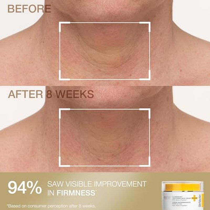 StriVectin Tighten and Lift Advanced Neck Cream PLUS with Alpha-3 Peptides for Neck and D?collet?, Smoothing Look of Wrinkles and Fine Lines, Improves Crepey Skin and Vertical Lines