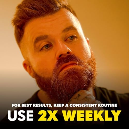 Beard Club Derma Roller & Beard Growth Oil - Microneedling Roller with 540 Titanium Coated Microneedles & Cedar, Sandalwood Beard Oil