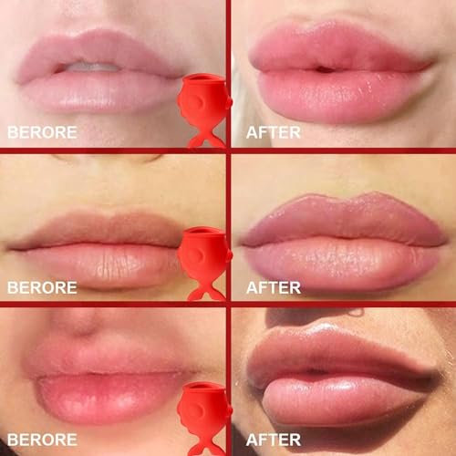 Fish Lip Plumper - Fish-Shaped Lip Suction Device, Longlasting Lip Enhancer Tool | Reusable Lip Plumping Beauty Device, Lightweight Lip Sucker Plumper Tool Suitable For Lip Care And Sexy Lip Mouth