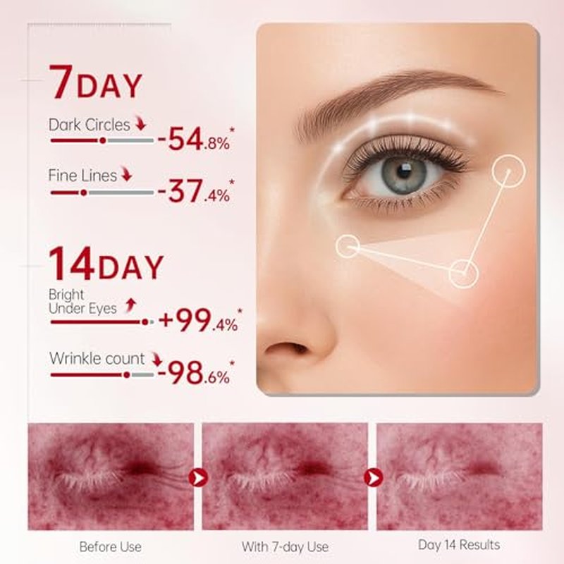 Peunitory Eye Balm Stick,Under Eye Cream Anti-Wrinkle Firming Treatment | Dark Circle Brightener | Hydrating (0.32oz)